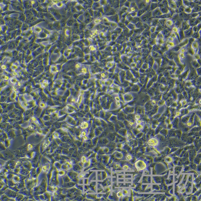 95-D [PLA-801D]（人高转移肺癌细胞） YB-71011HC - 钰博生物官方商城 - 钰博生物-试剂盒,ELISA试剂盒,检测 ...